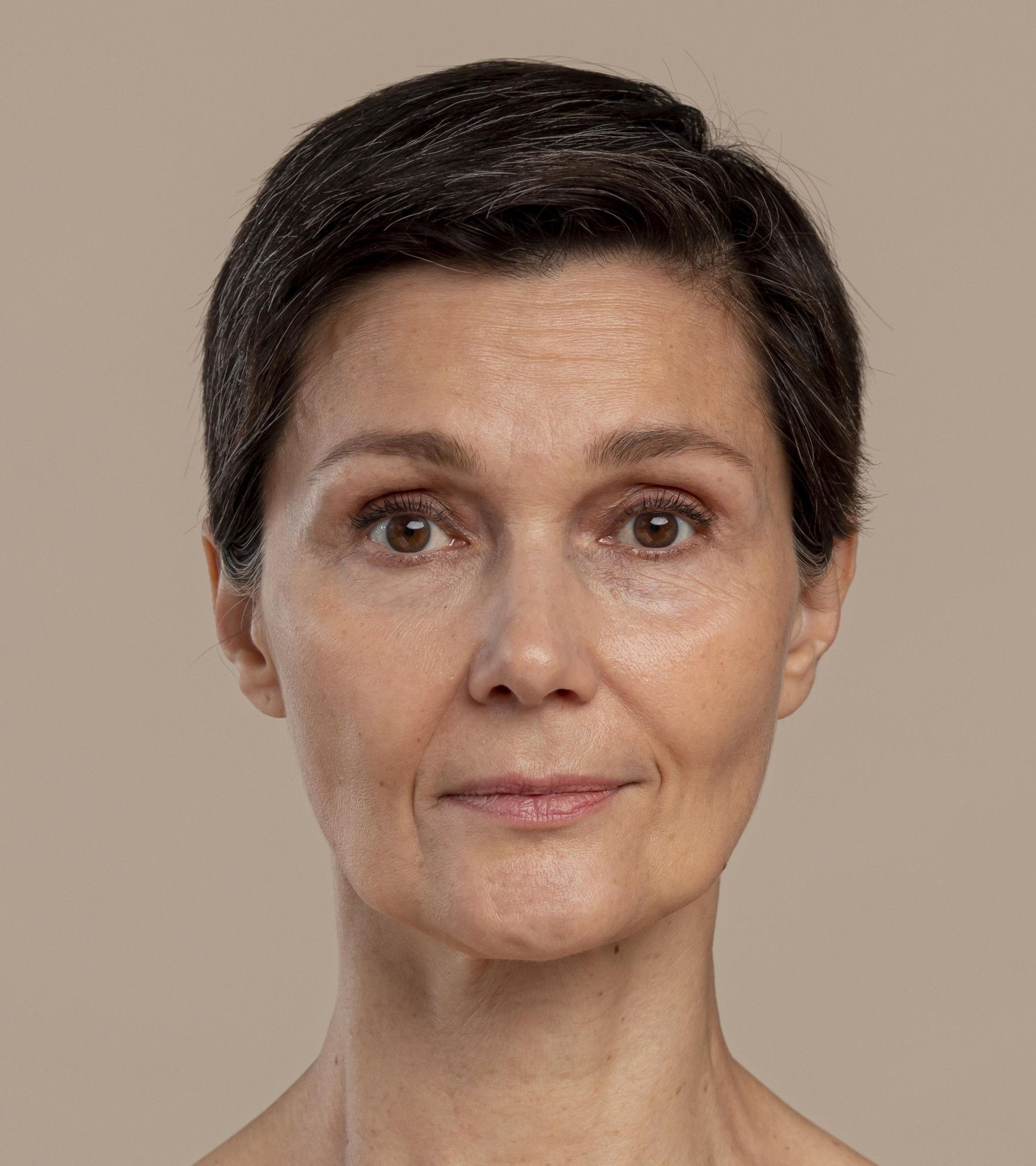 huidverslapping-1.jpg