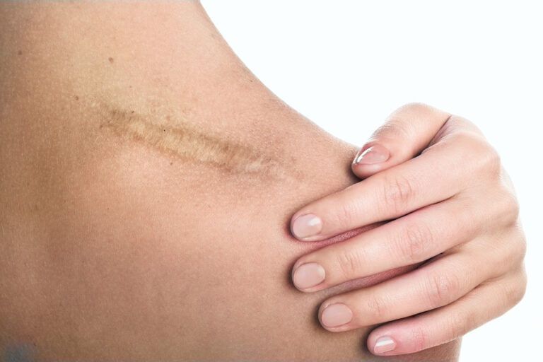scars-768x512.jpg